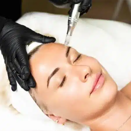 Microneedling & Regenerative Treatments