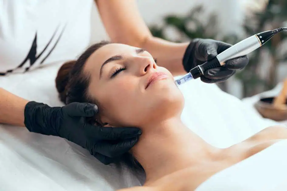 Why Microneedling Continues To Be A Trusted Treatment