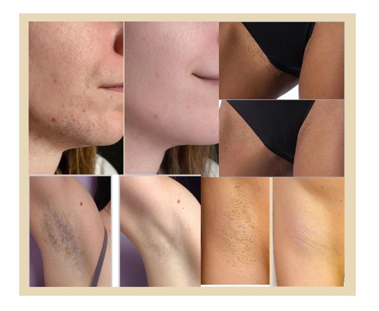 A Personalized Approach