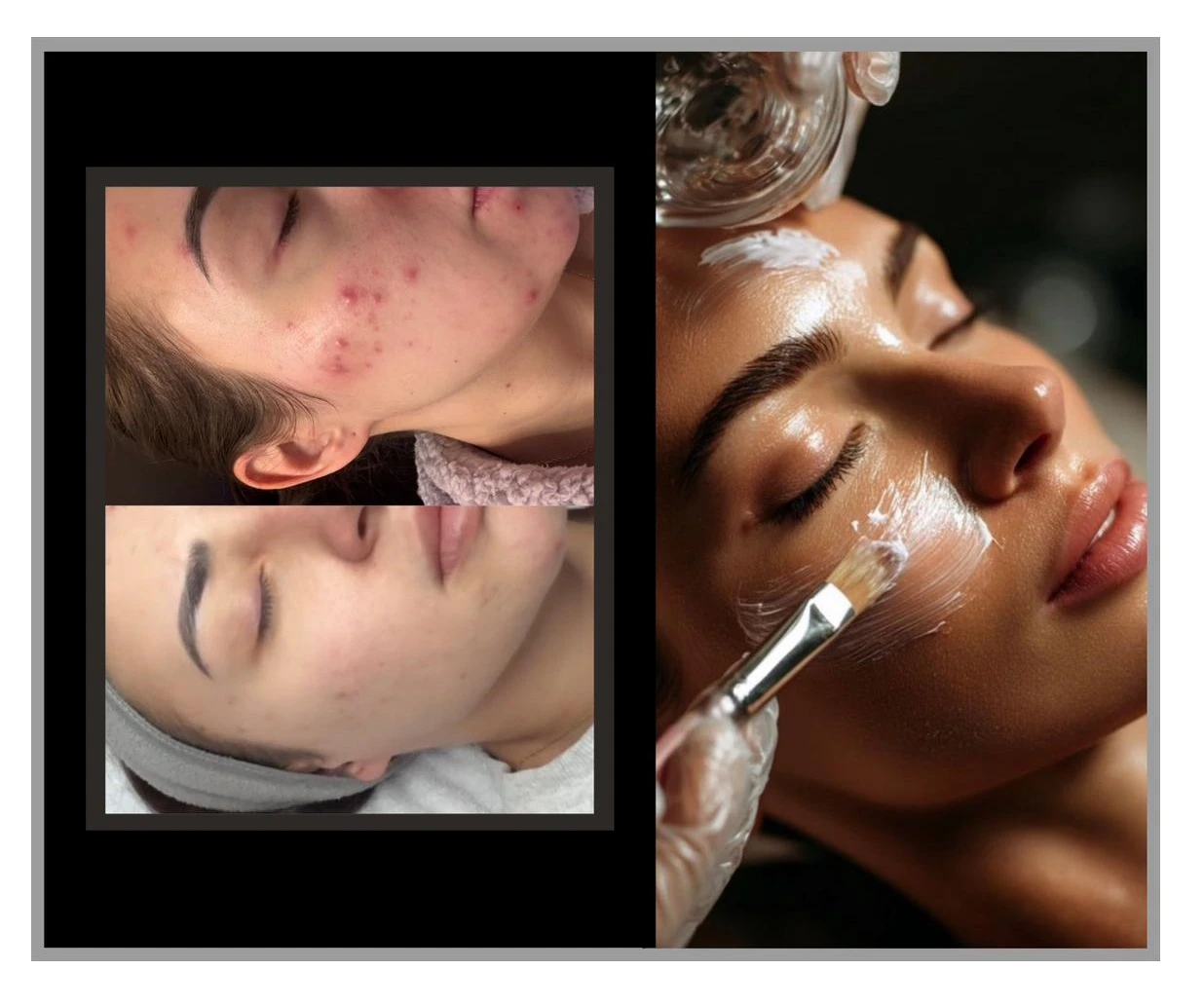 Treatments Commonly Used In Skin Correction