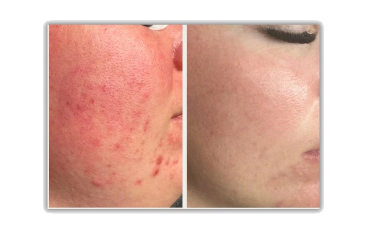 Corrective Skin Care, Guided By Understanding, Not Guesswork